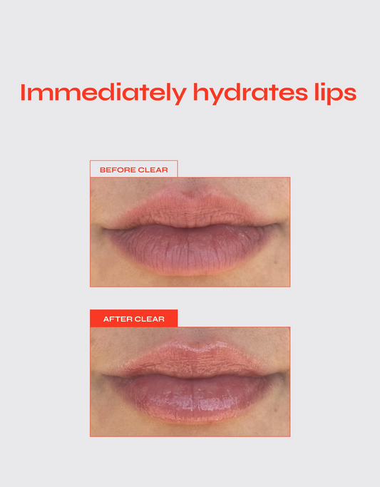 Lip Jelly